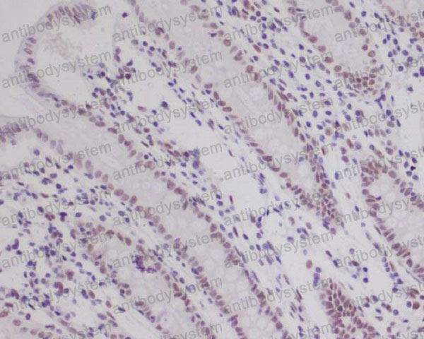 Anti-ARNT/HIF1-beta Antibody (R1C41)