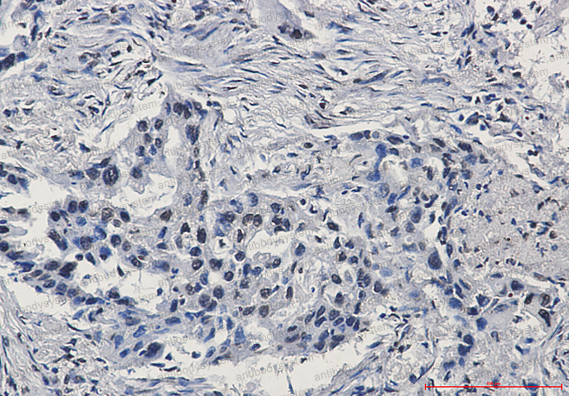 Anti-ARNT/HIF1-beta Antibody (R1T35)