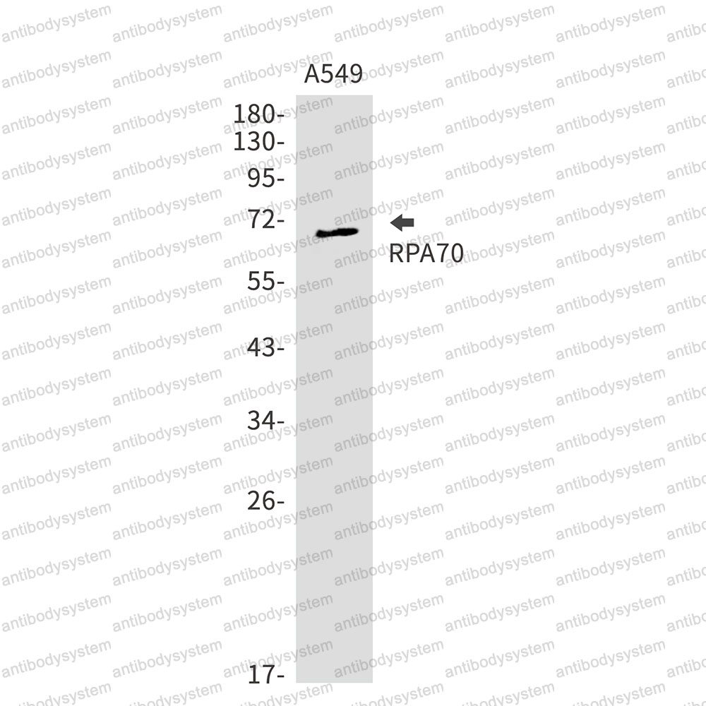 Anti-RPA1 Antibody (R1T36)
