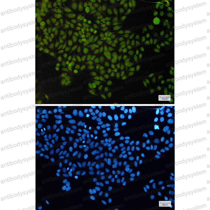 Anti-APEX1 Antibody (R1T37)