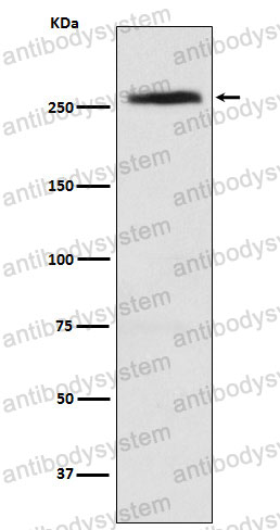 Anti-CAD Antibody (R1T38)