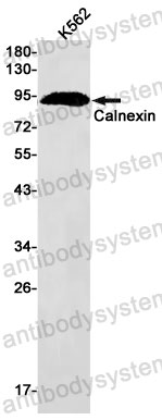 Anti-CANX Antibody (R1T39)