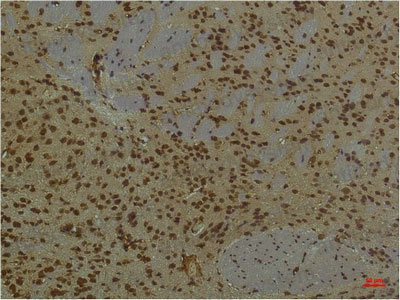 Immunohistochemical for Anti-PIK3R1/PI3-kinase p85-alpha Antibody (R3H48) ?>