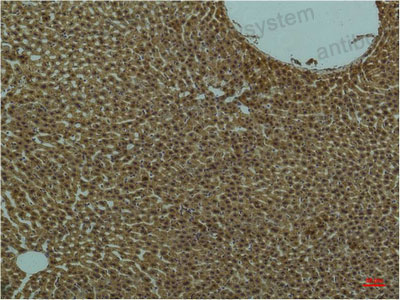 Immunohistochemical for Anti-PIK3R1/PI3-kinase p85-alpha Antibody (R3H48) ?>