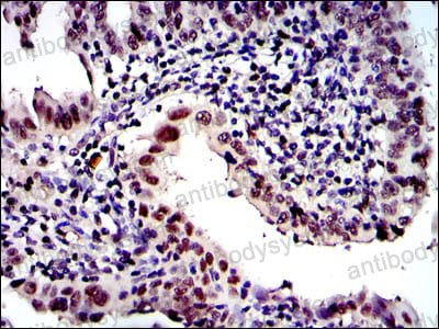 Immunohistochemical for Anti-PSMB8 Antibody (R3H50) ?>