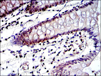 Immunohistochemical for Anti-PSMB8 Antibody (R3H50) ?>