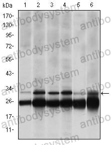 Western blot for Anti-PSMB8 Antibody (R3H50) ?>