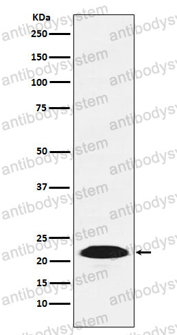 Anti-PSB9/LMP2 Antibody (R1T43)