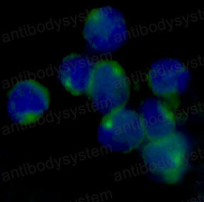 Anti-LOX Antibody (R1T46)