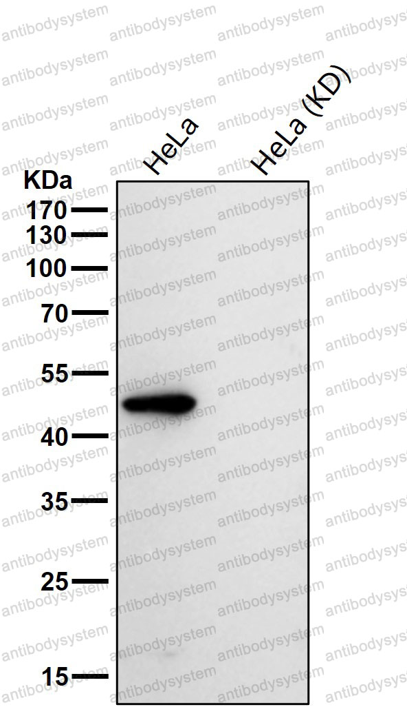 Anti-LAP3 Antibody (R1B82)