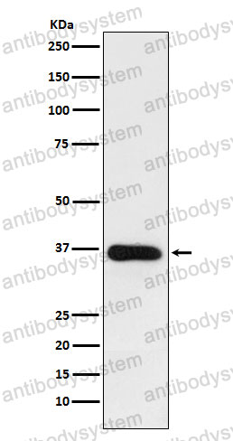 Anti-HSD11B1 Antibody (R1T62)