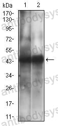 Western blot for Anti-CD38/ADPRC 1 Antibody (R3H60) ?>