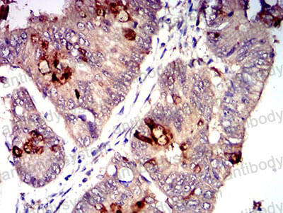 Immunohistochemical for Anti-CD1c Antibody (R3H68) ?>