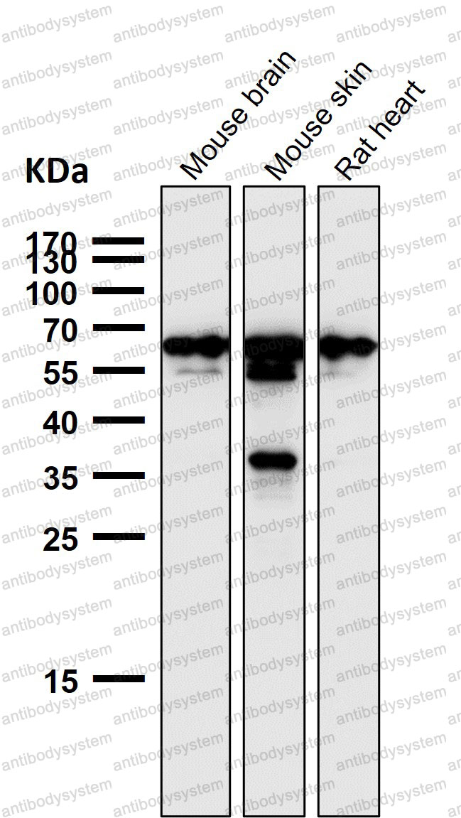Anti-GTF2E1 Antibody (R1T63)
