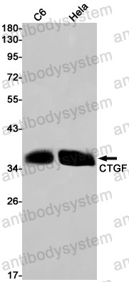 Anti-CTGF/CCN2 Antibody (R1T64)