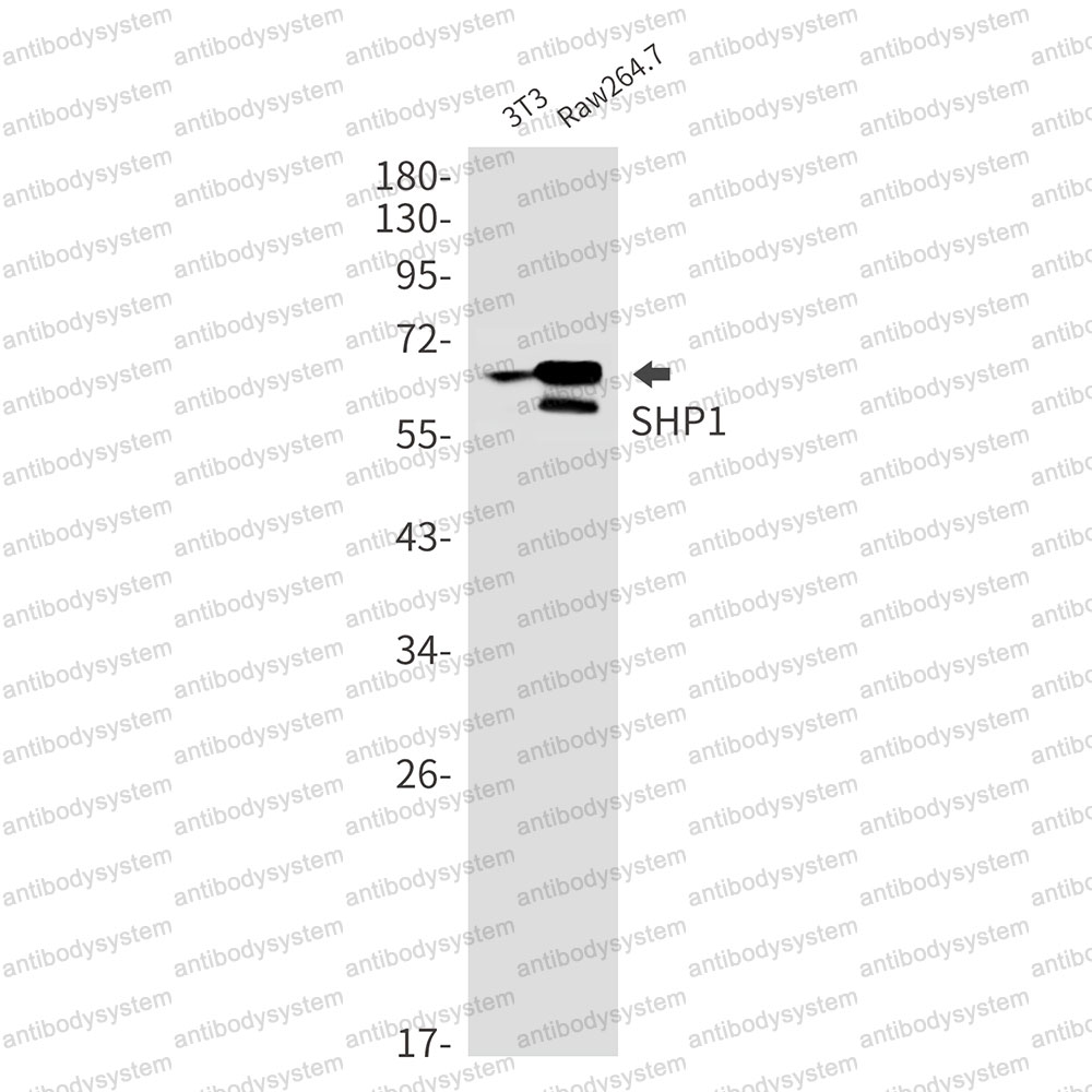 Anti-PTPN6 Antibody (R1T66)