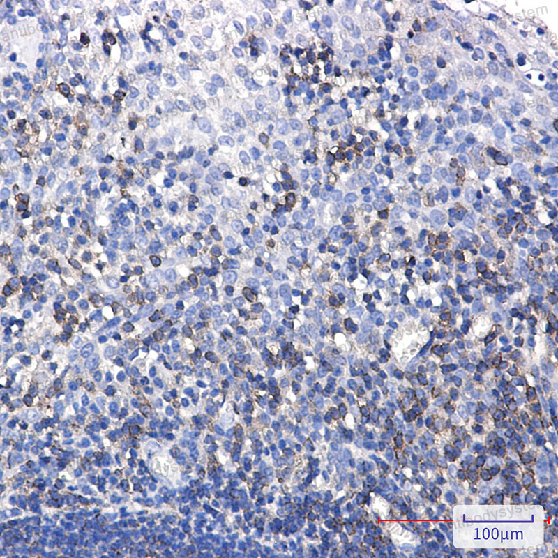 Anti-PTPN6 Antibody (R1T65)