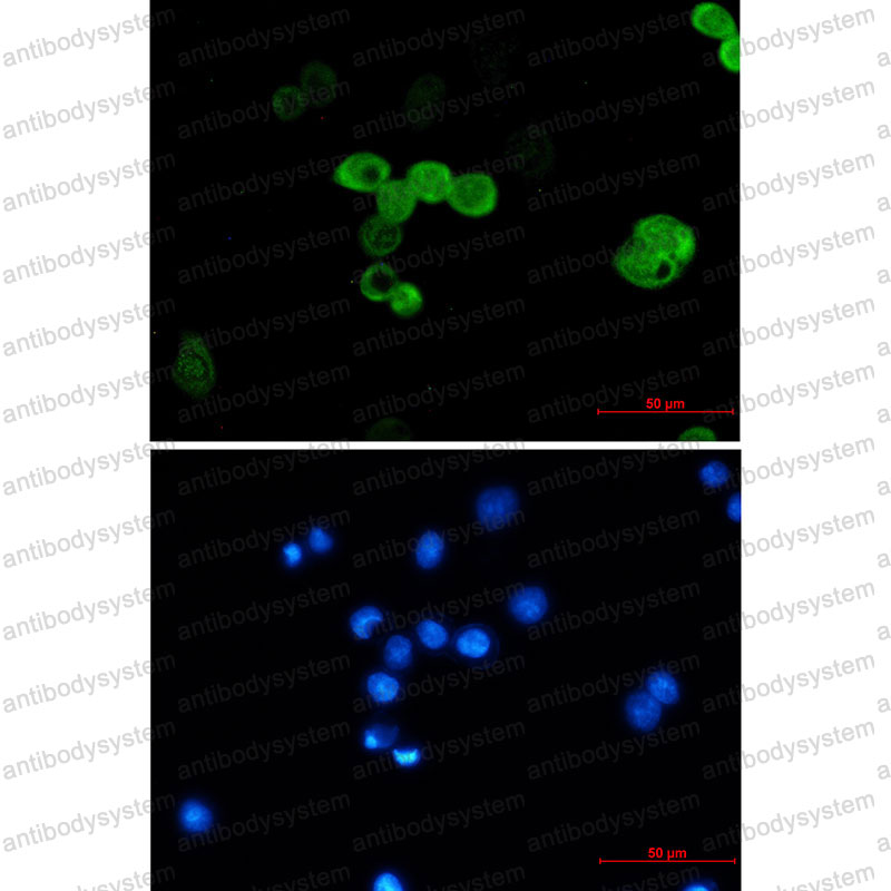 Anti-CRABP2 Antibody (R1T68)