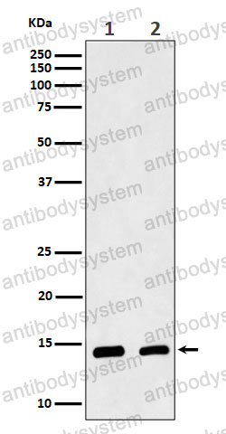 Anti-CRABP2 Antibody (R1T67)
