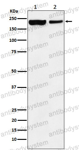 Anti-KDM5A Antibody (R1T69)