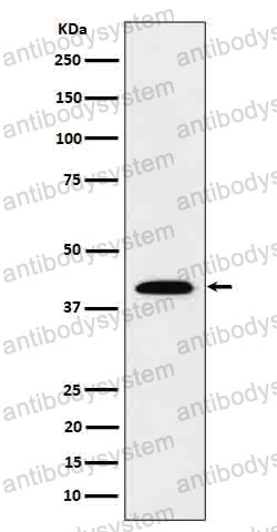 Anti-IL12B/IL-12 p40/NKSF2 Antibody (R1T73)