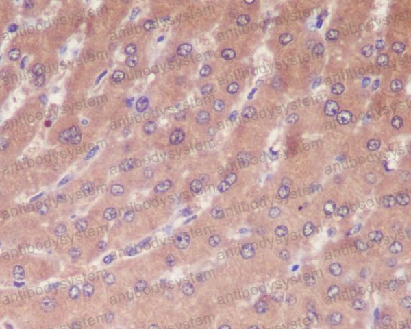 Anti-CASP1/Caspase-1 Antibody (R1B68)