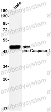 Anti-CASP1/Caspase-1 Antibody (R1T75)
