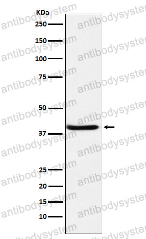 Anti-SERPINB3 Antibody (R1T76)