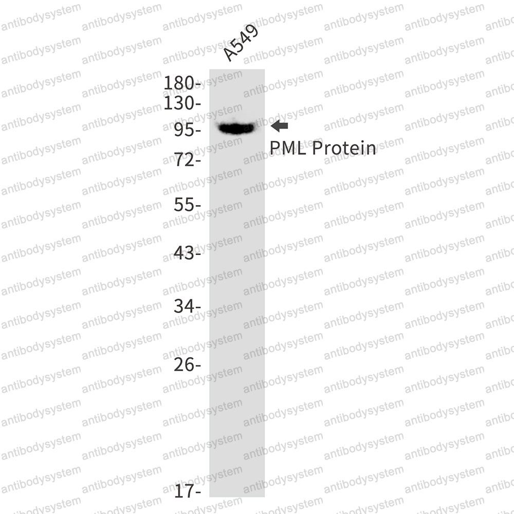 Anti-PML Antibody (R1T79)