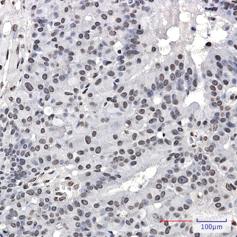 Anti-Phospho-PML (Ser518) Antibody (R1T78)