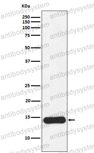 Anti-CRABP1 Antibody (R1T80)