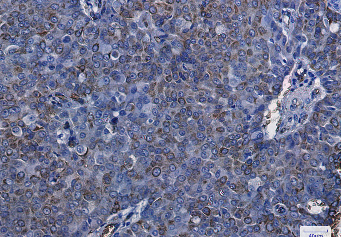 Anti-AQP1 Antibody (R1T82)