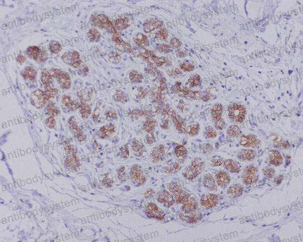 Anti-AQP1 Antibody (R1T81)