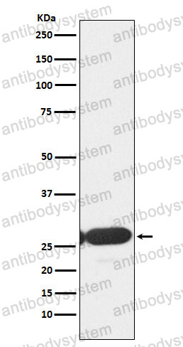 Anti-ERP29 Antibody (R1T83)
