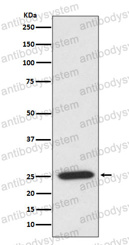 Anti-PRDX6 Antibody (R1T84)