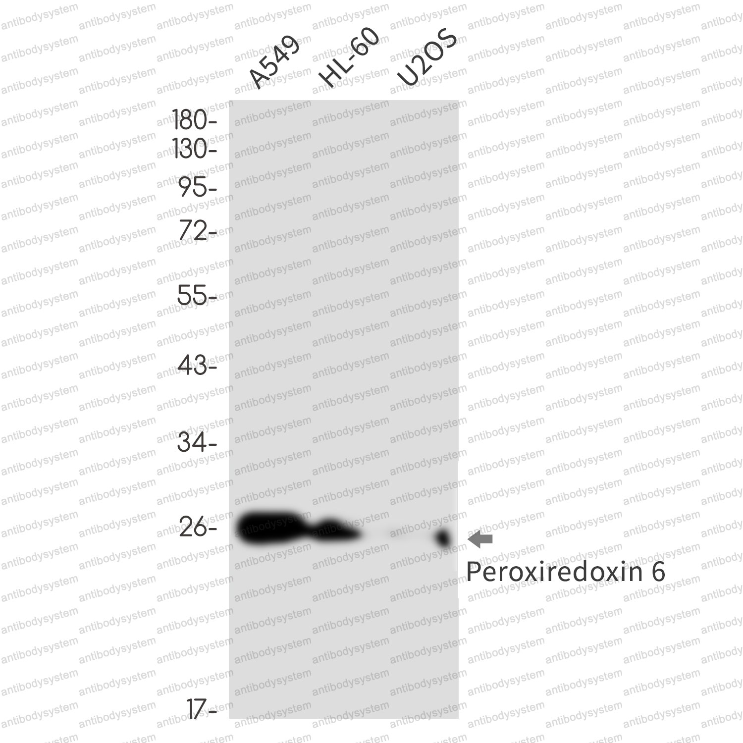 Anti-PRDX6 Antibody (R1T85)