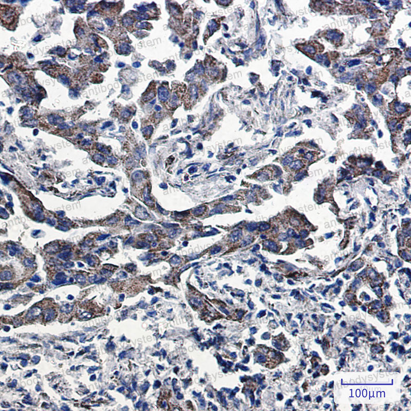 Anti-PRDX5 Antibody (R1T87)