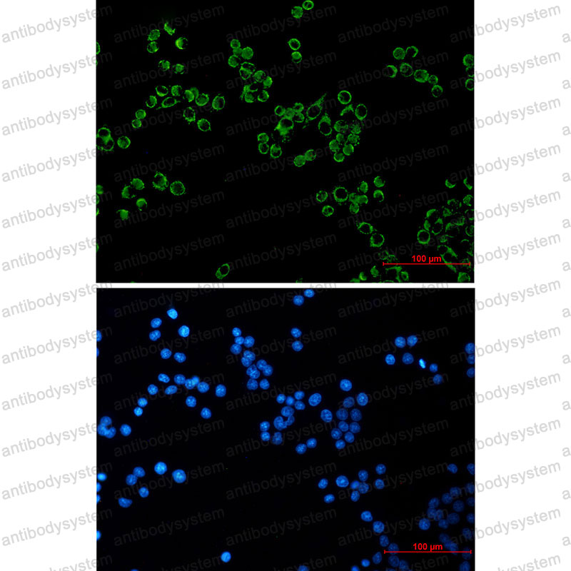 Anti-PRDX3 Antibody (R1T89)
