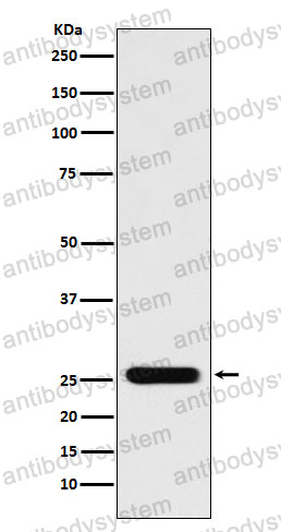 Anti-PRDX3 Antibody (R1T88)