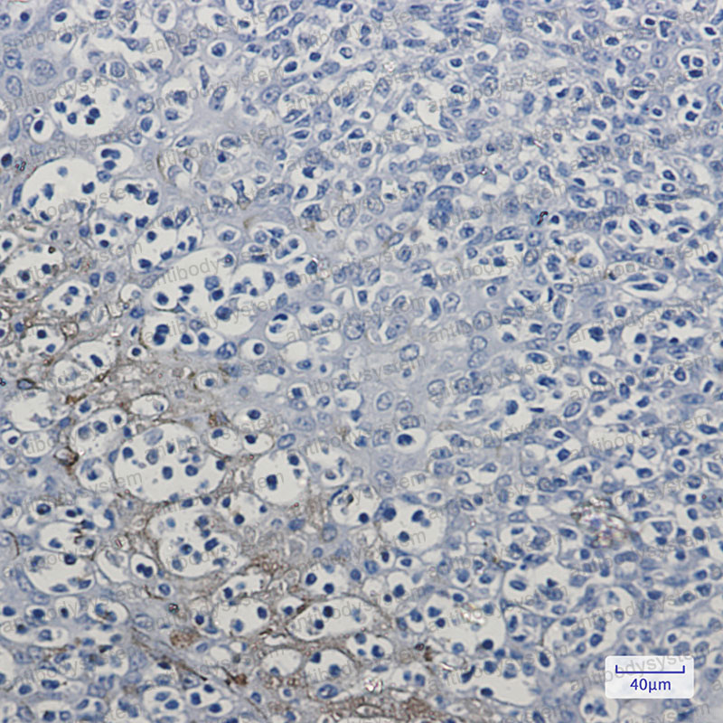 Anti-PEBP1 Antibody (R1T91)