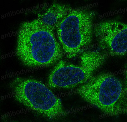 Anti-PEBP1 Antibody (R1T90)