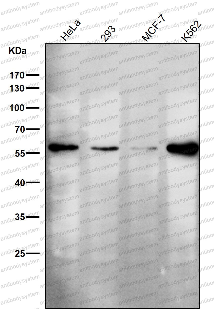 Anti-PDIA3 Antibody (R1T92)