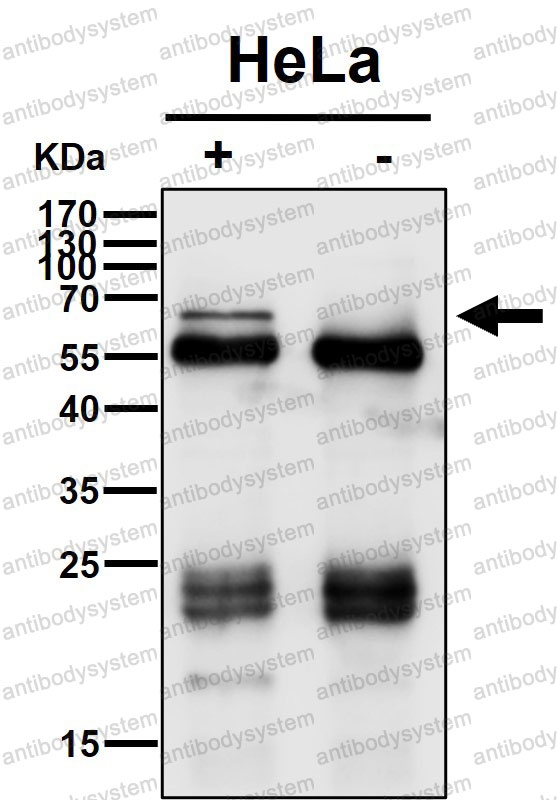 Anti-CDC25B Antibody (R1T94)