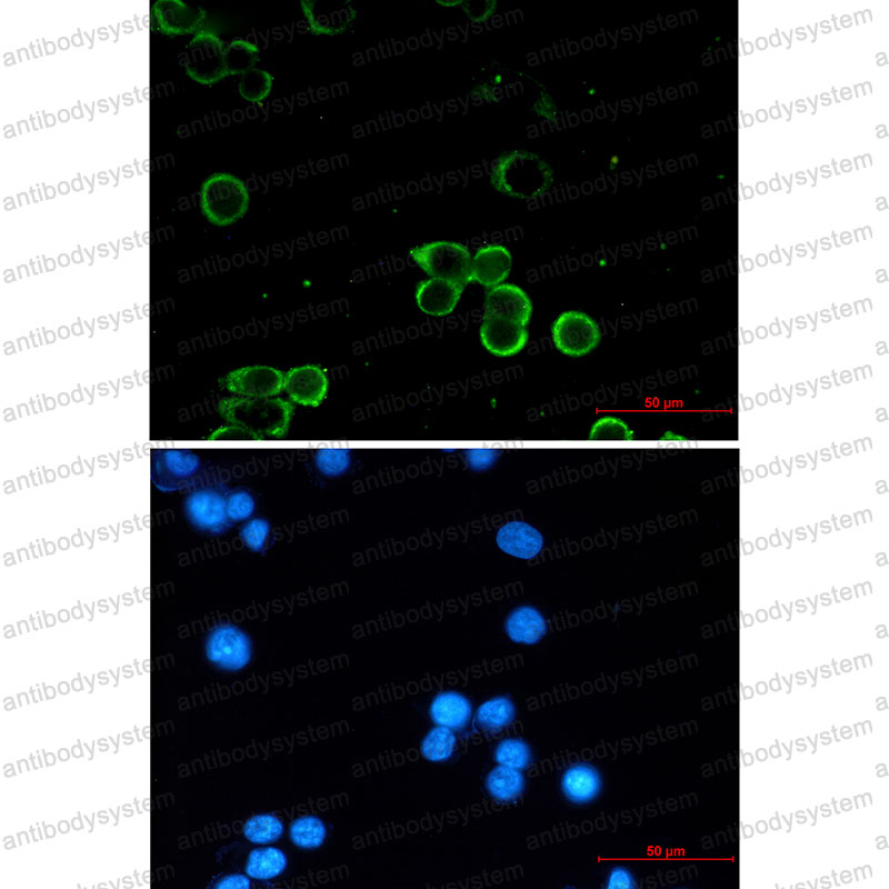 Anti-ADORA1 Antibody (R1U05)