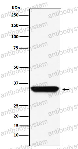 Anti-ADORA1 Antibody (R1U04)
