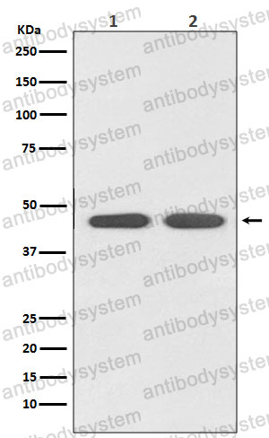 Anti-AGTR1 Antibody (R1U06)