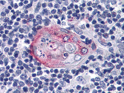 Immunohistochemical for Anti-AKT2 Antibody (R3J20) ?>