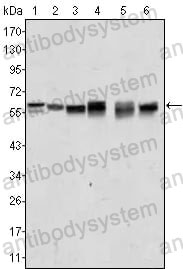 Western blot for Anti-AKT2 Antibody (R3J20) ?>