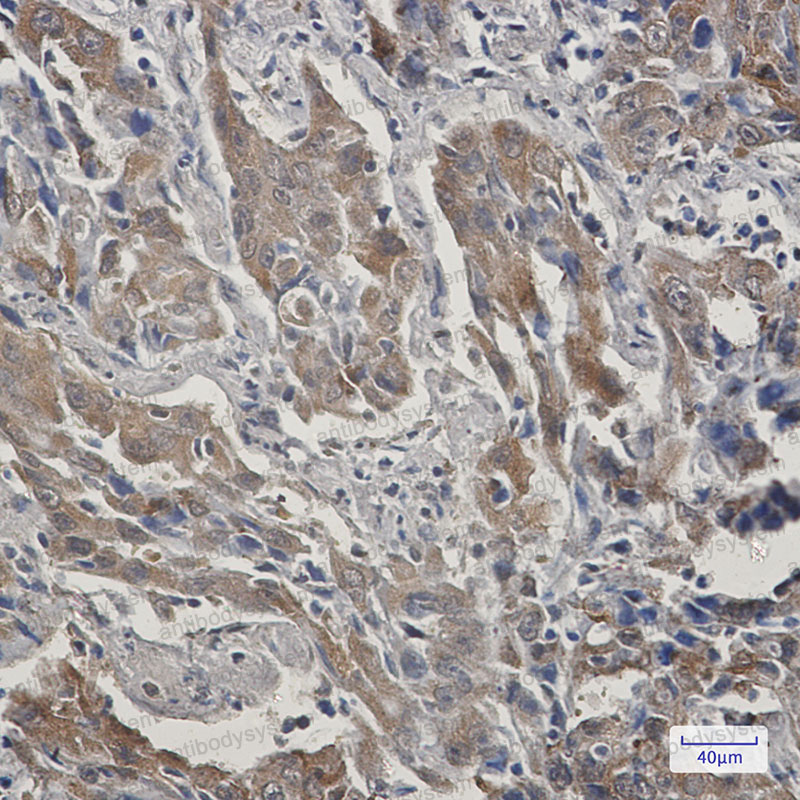 Anti-STIP1 Antibody (R1U39)
