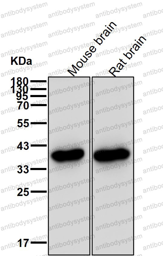 Anti-OTX1 Antibody (R1A92)